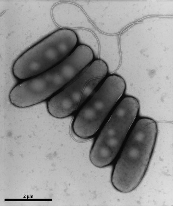 Legionella pneumophila. Raster-Elektronenmikroskopie. Maßstab = 1 µm. Legionella pneumophila. Raster-Elektronenmikroskopie. Maßstab = 1 µm.